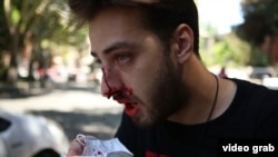 Una dintre victimele atacului protestatarilor anti-LGBT.