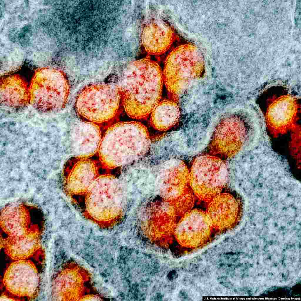 Virionii de coronavirus au circa 120 nanometri în diametru, ceea ce înseamnă că vreo 750 de virioni puși unul lângă altul ajung să aibă diametrul unui fir de păr uman.